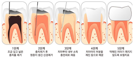 참좋은치과 이미지