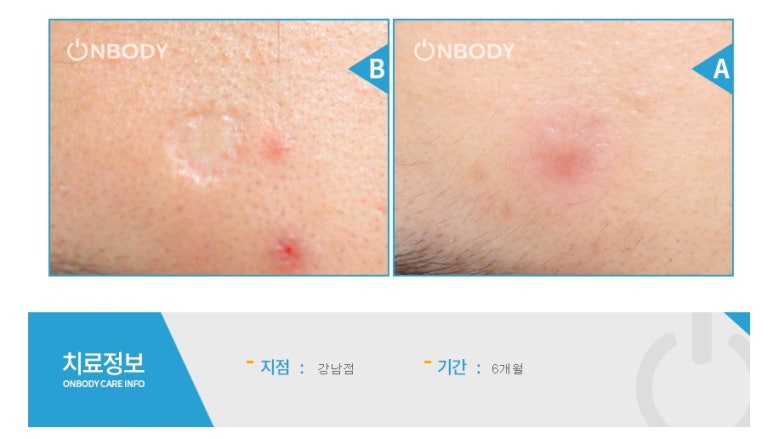 채워지다 이미지