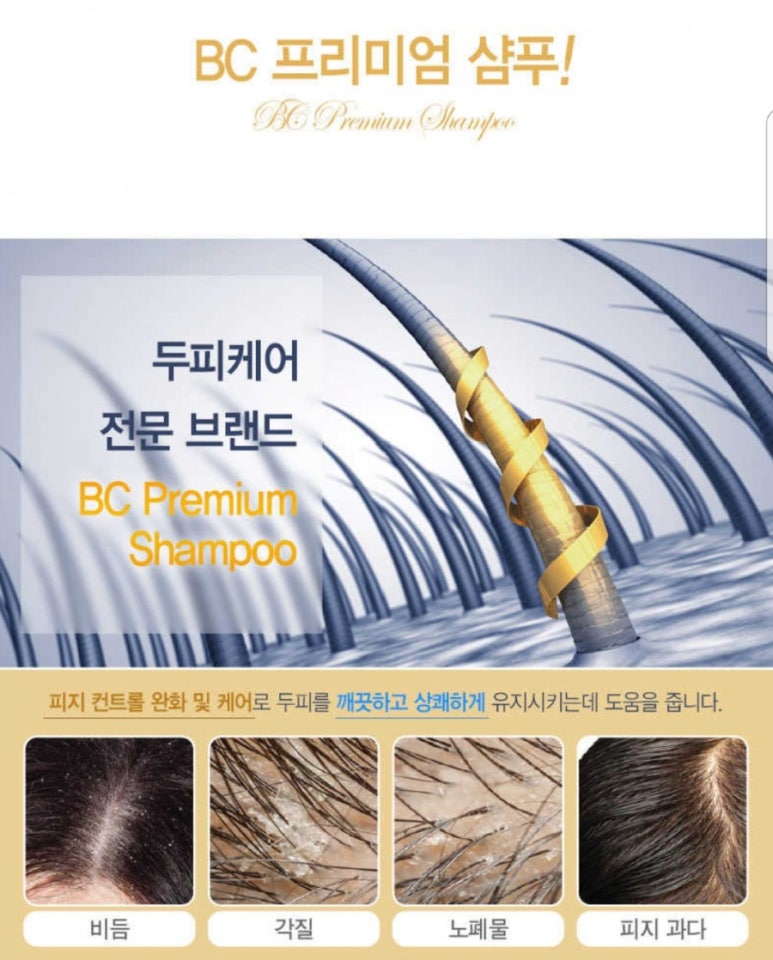 탈모야놀자 이미지