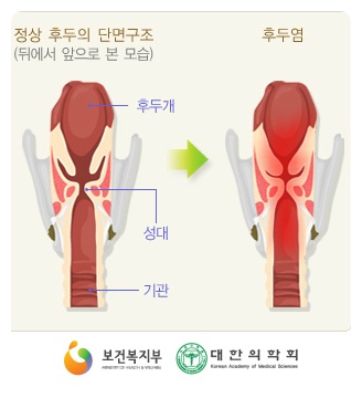예가부부한의원 이미지