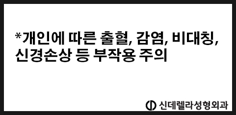 신데렐라성형외과의원 이미지