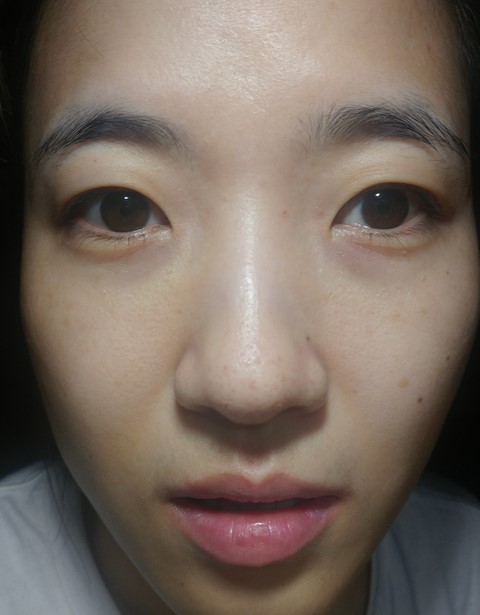 미도테라피 이미지