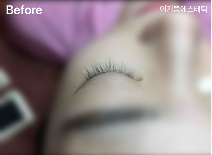 비송에스테틱 이미지