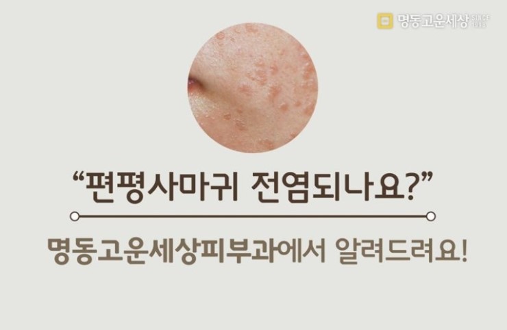명동고운세상피부과의원 이미지
