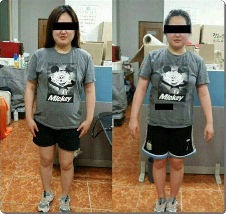 효소체형관리 이미지