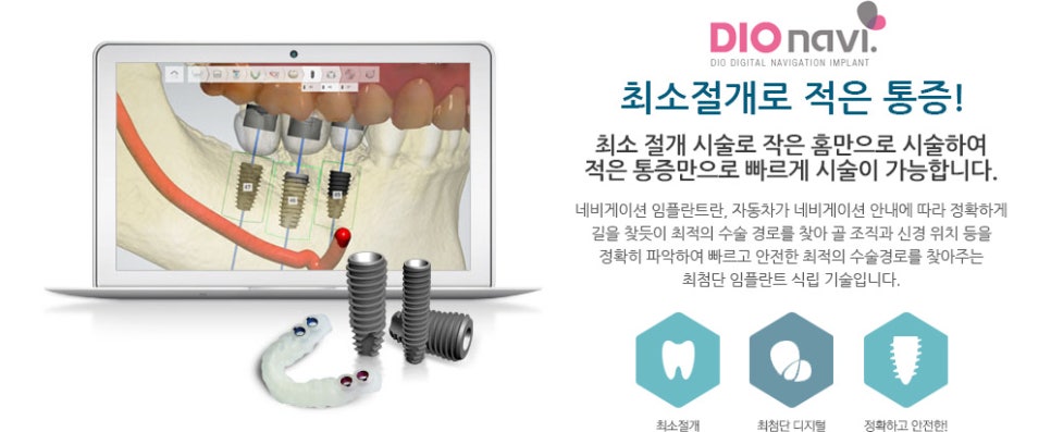 서울테라치과 이미지