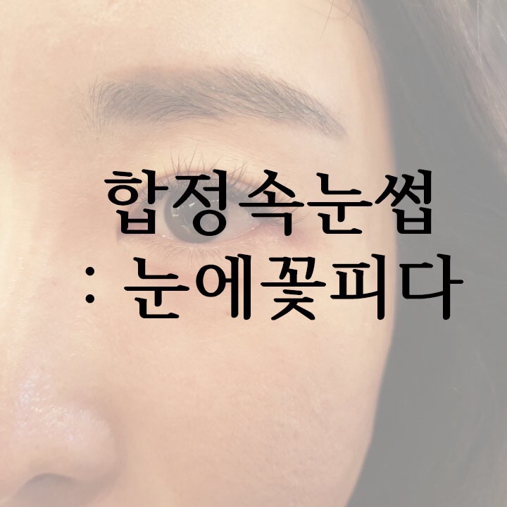 눈에꽃피다 이미지