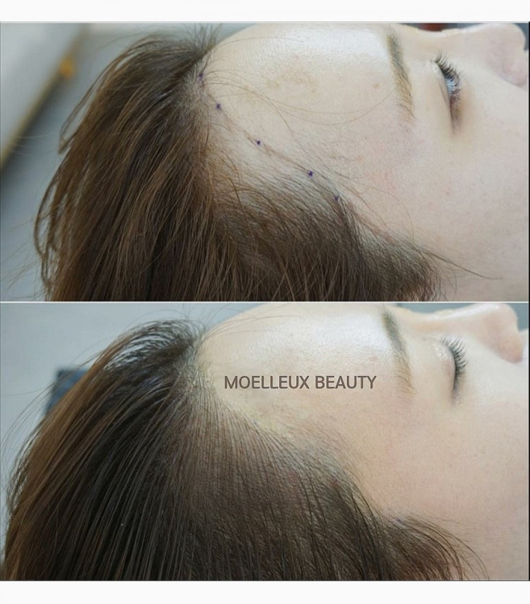 뷰티헤어라인 이미지