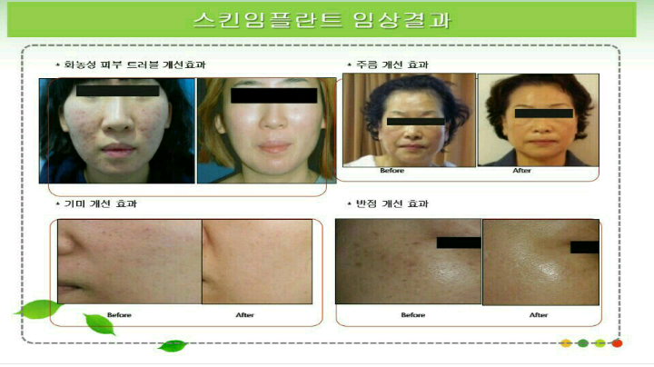 에이스휴먼 이미지