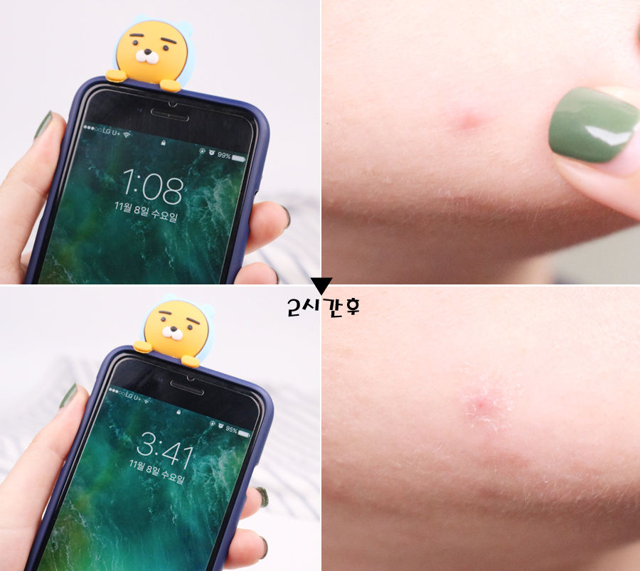 케이큐어 이미지