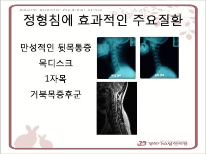 퀸스테이블 이미지