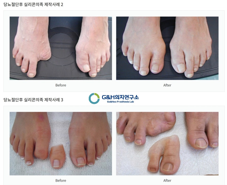 한국의지보조기학회 이미지