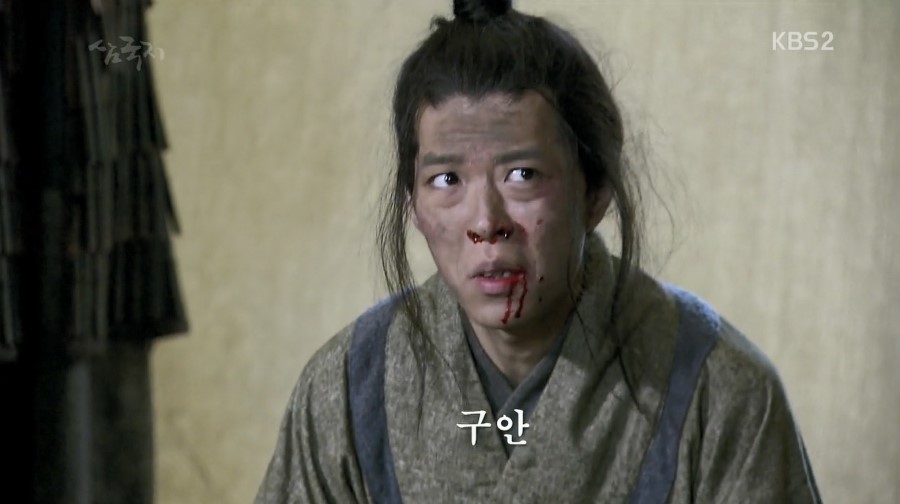 구안 이미지