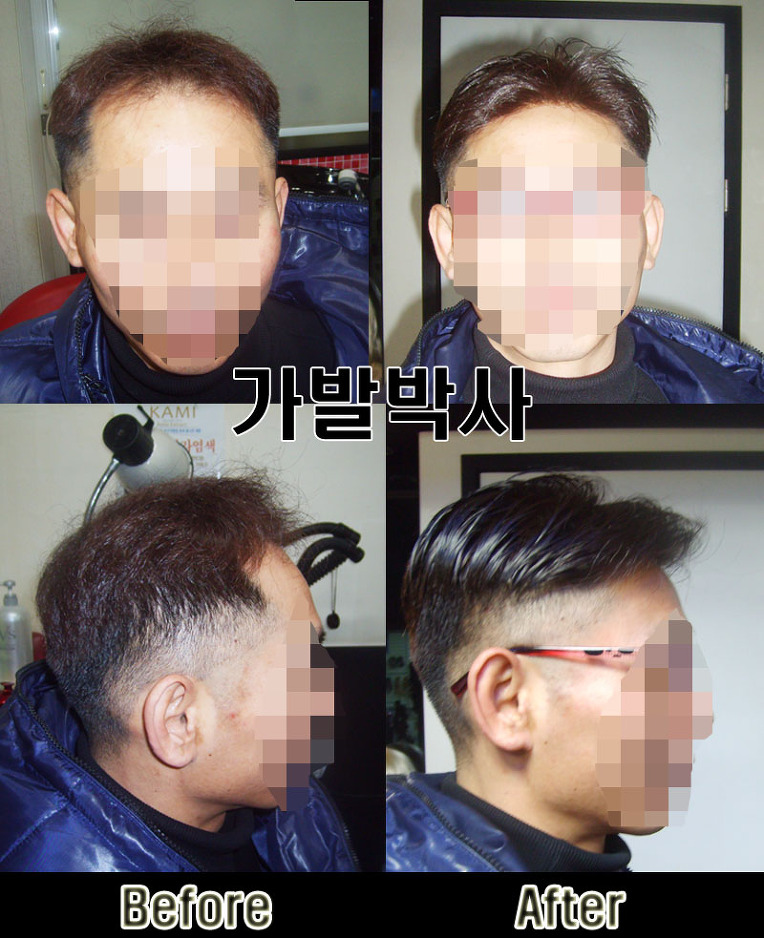 가발박사 이미지