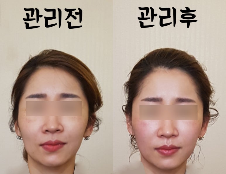 미소힐링아로마테라피 이미지