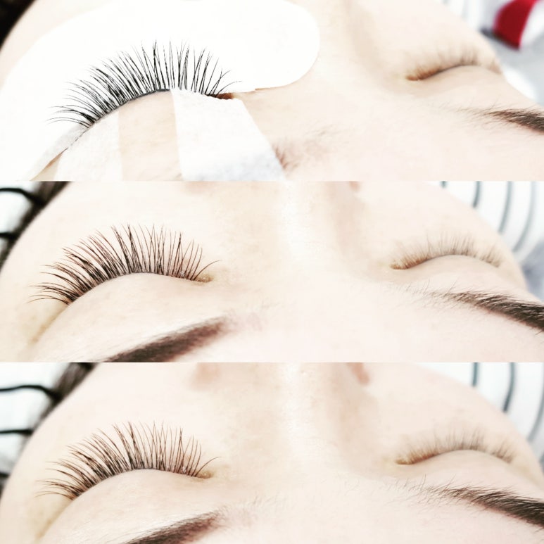 EYE이뻐 이미지