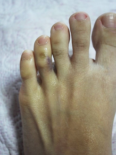 조아스포츠마사지 이미지