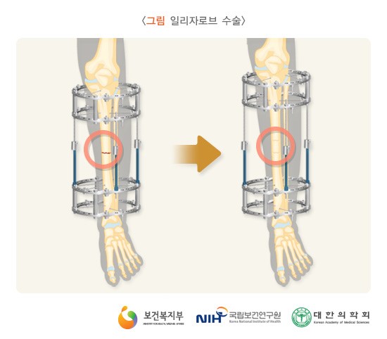 신발신고 이미지