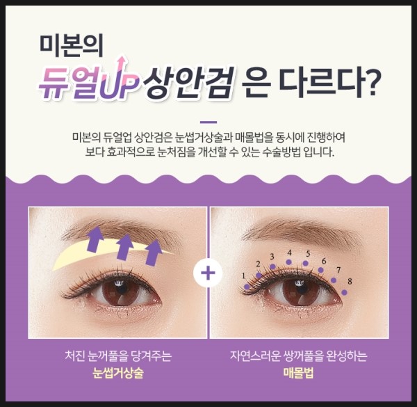 미본 이미지