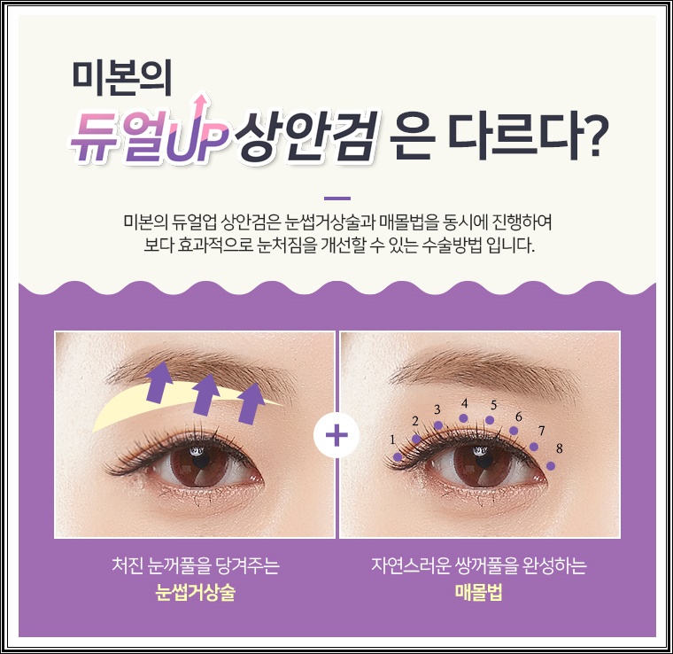 미본 이미지