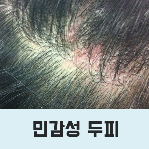 샴푸미용실 이미지