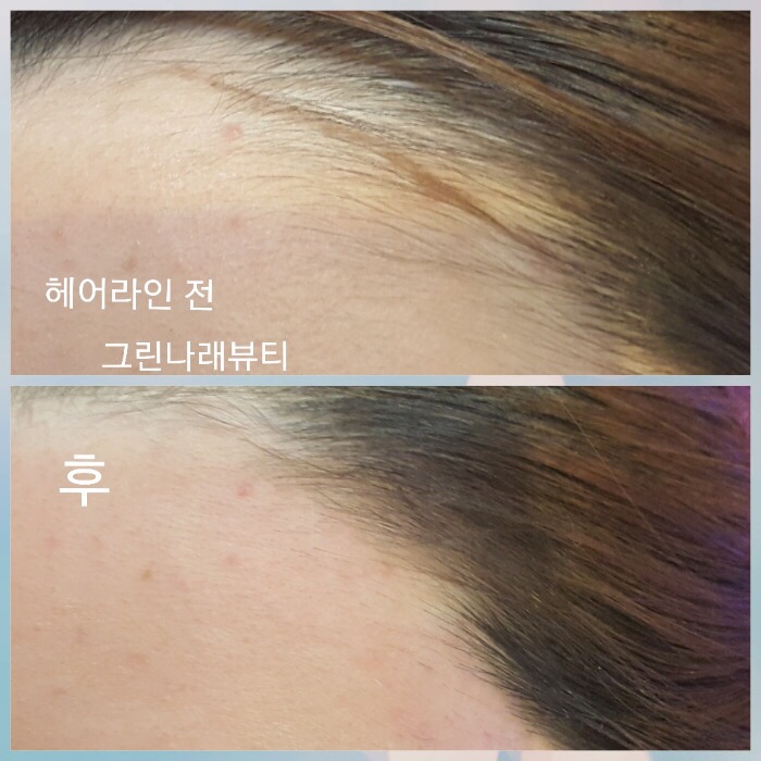 그린뷰티 이미지