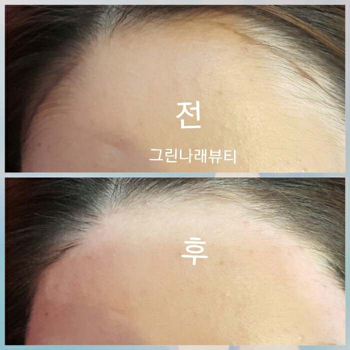 그린나래헤어 이미지