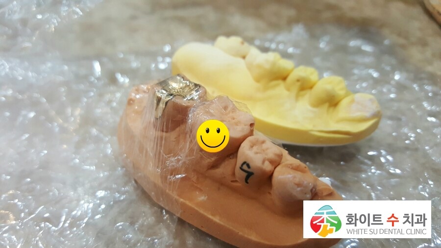 화이트수치과의원 이미지