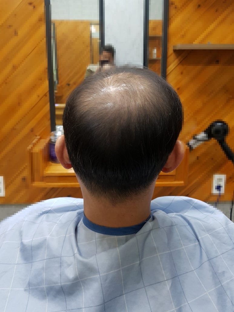 플러스모발센터 이미지