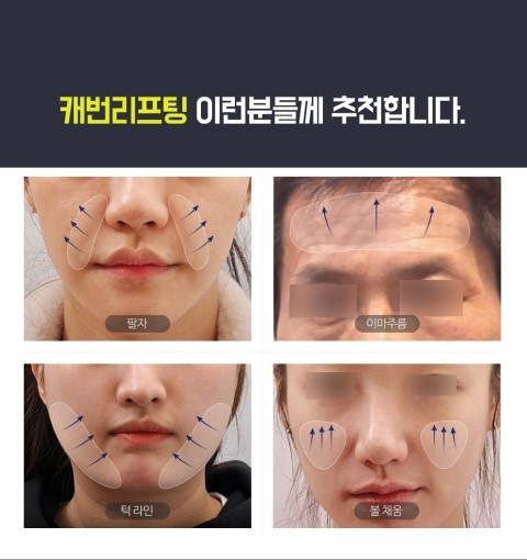 클린업피부과청담점 이미지
