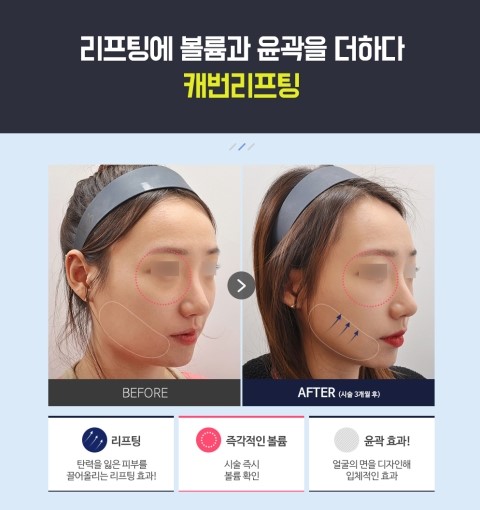 클린업피부과청담점 이미지