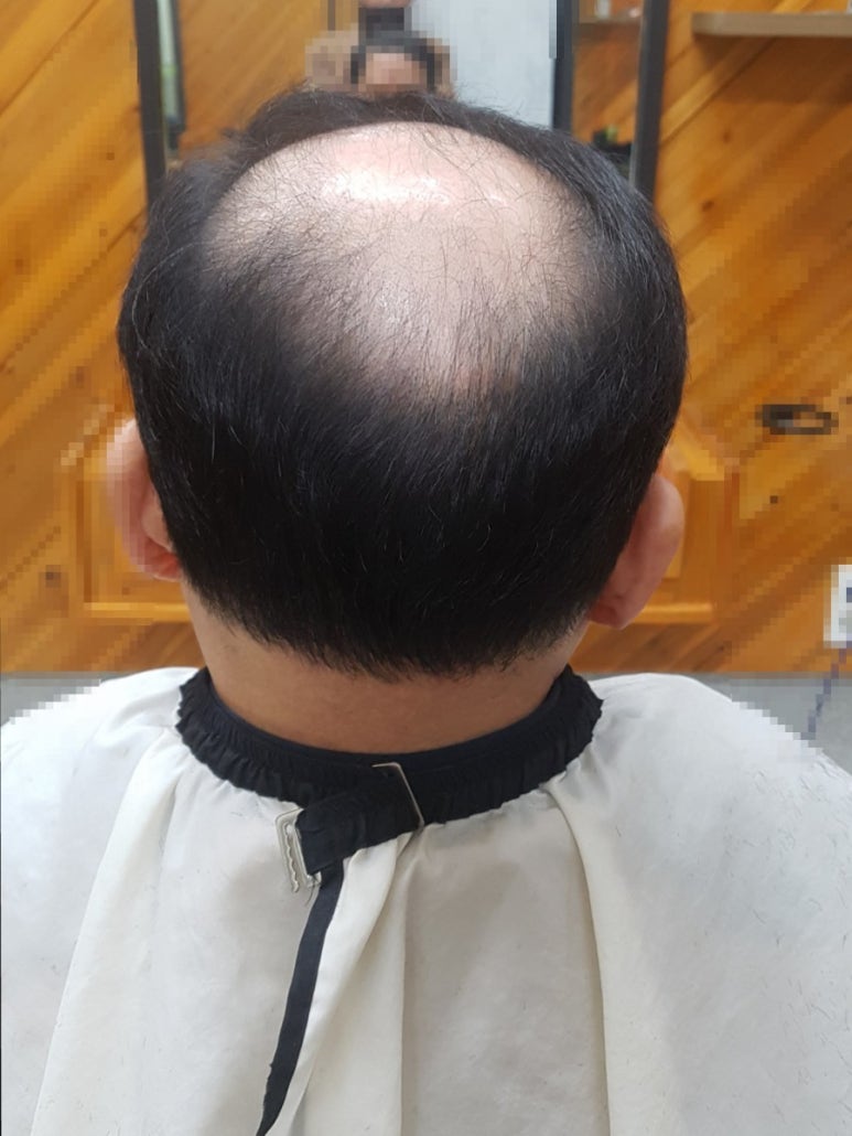 플러스모발센터 이미지