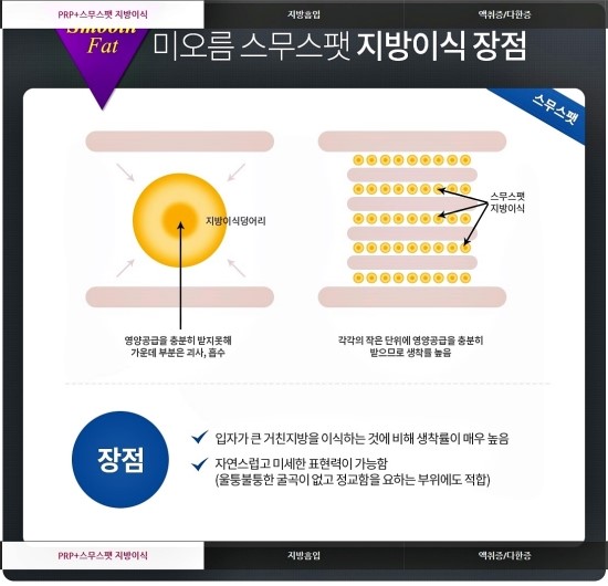 미오름 이미지