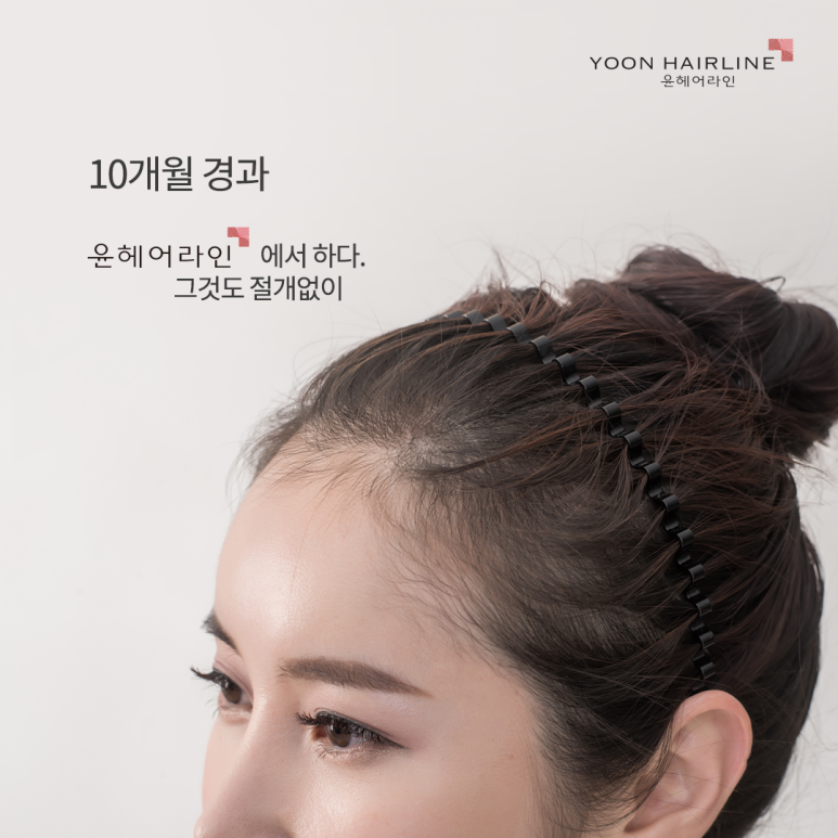 헤어온의원 이미지