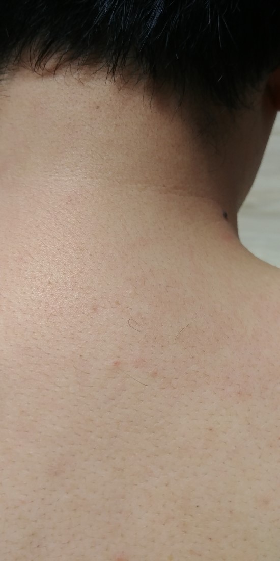 조아스포츠마사지 이미지