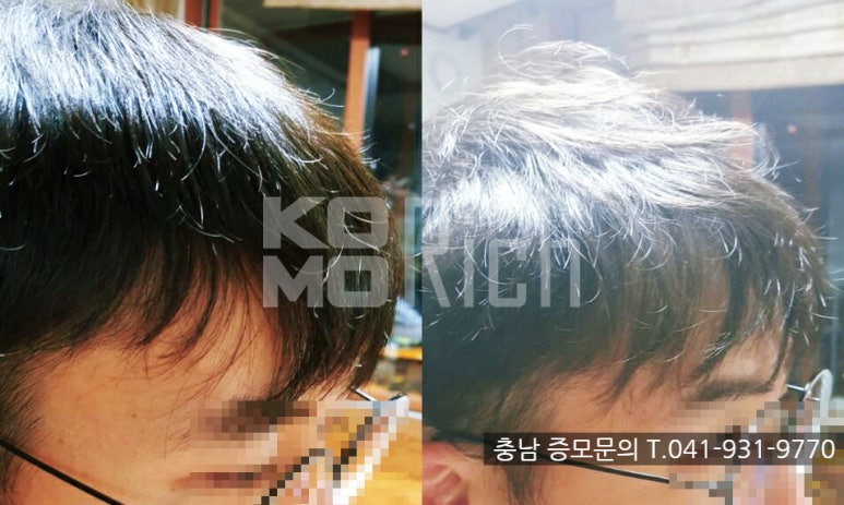 코모리치보령센터 이미지