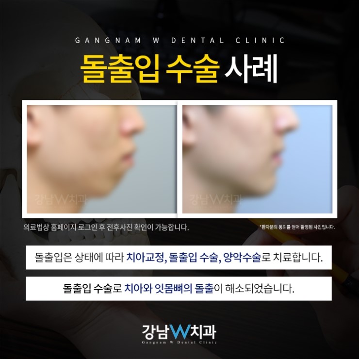 강남더블유치과 이미지