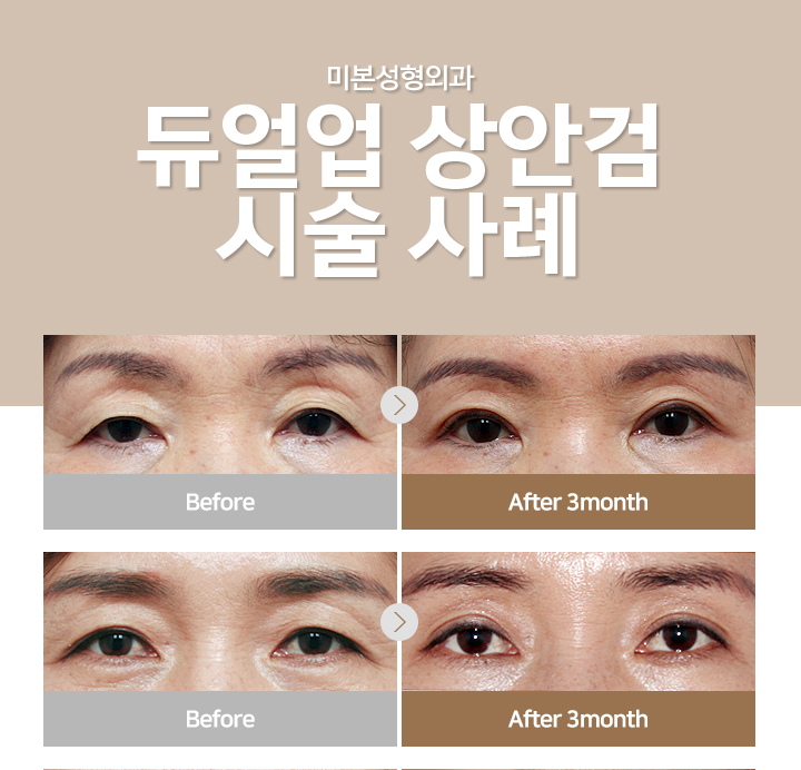 미본 이미지