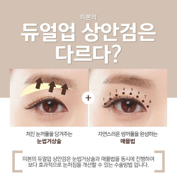 미본 이미지