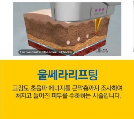 초이샵 이미지