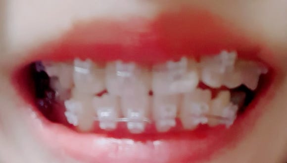 불당치과교정과치과의원 이미지