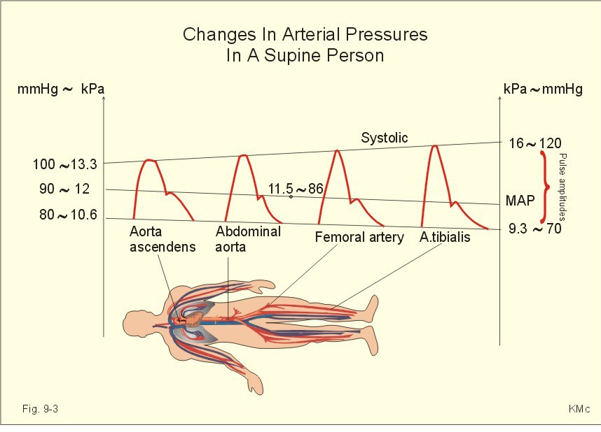 Arterial line monitoring, Aline(ABP, 동맥내혈압)에 대해서. 네이버 블로그