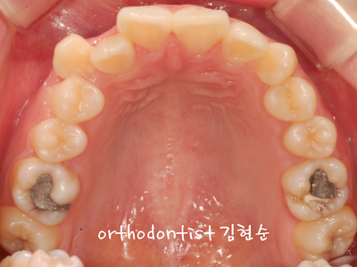 강남토끼 이미지