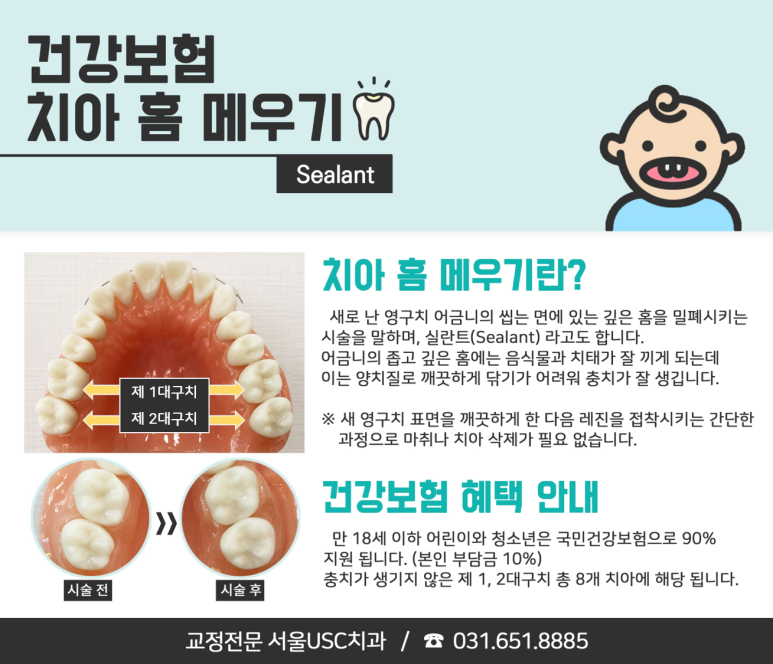 서울USC치과 이미지