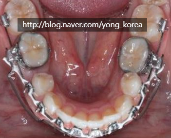 서울USC치과 이미지