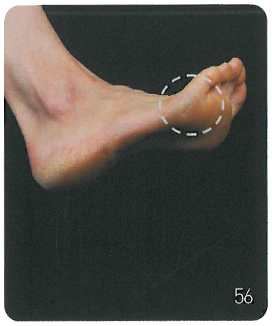 광족 이미지