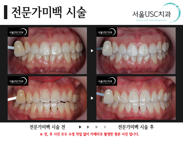 서울USC치과 이미지
