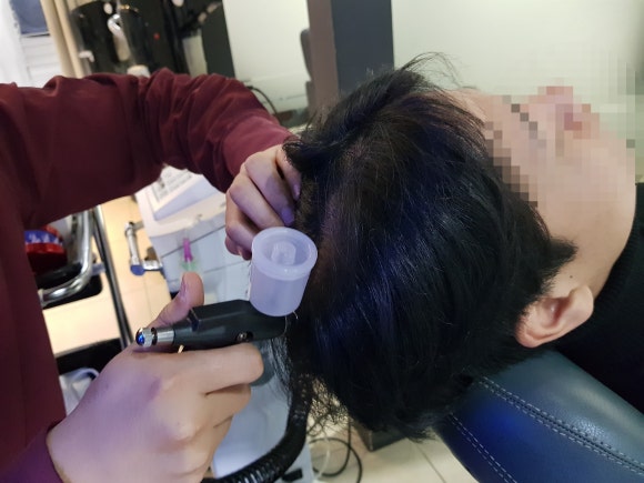 비타브리드스칼프케어 이미지