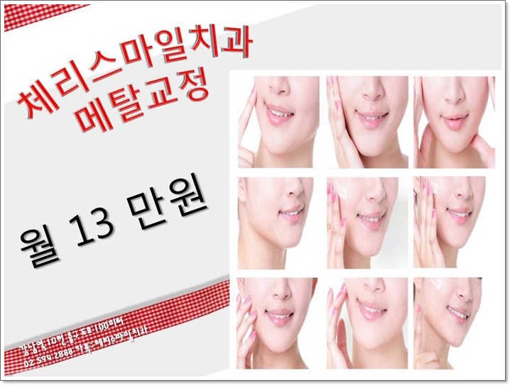 스마일치과 이미지