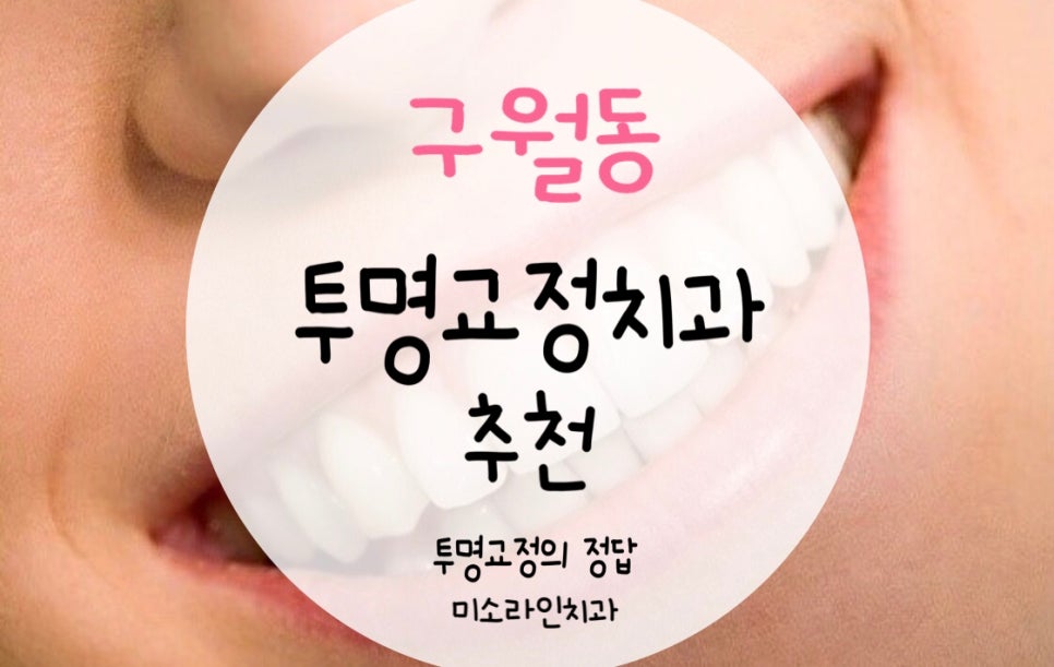 미소라인 이미지